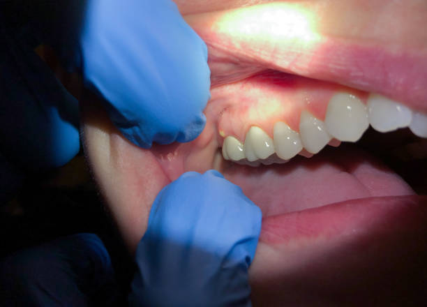 Best Broken or Cracked Tooth Emergency Dentist in Stigler, OK