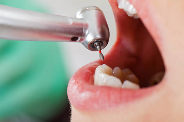 Best Emergency Dentist for Lost Fillings or Crowns in Stigler, OK